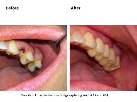 Clinical photograph for patient case 2
