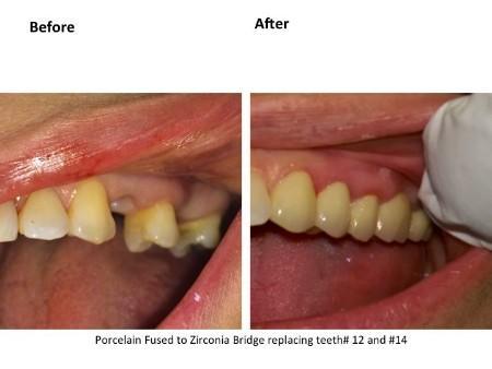 Clinical photograph for patient case 3