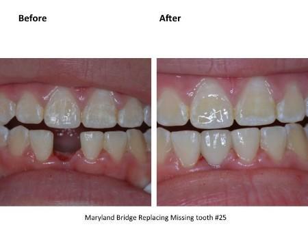 Clinical photograph for patient case 4