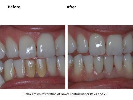 Clinical photograph for patient case 5