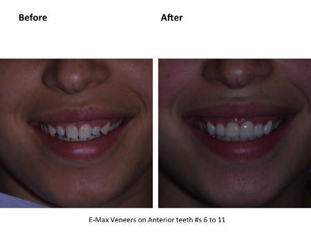 Clinical photograph for patient case 6