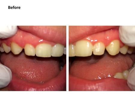 Clinical photograph for patient case 7
