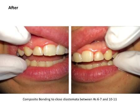 Clinical photograph for patient case 8