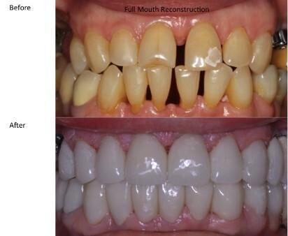 Clinical photograph for case 9