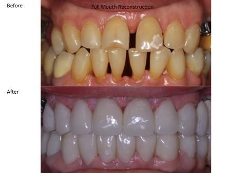 Clinical photograph for patient case 9